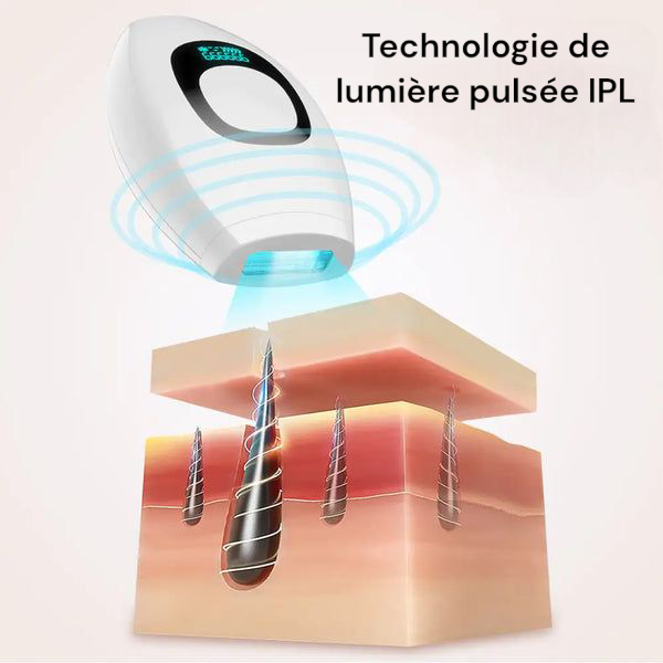 Épilateur laser maison